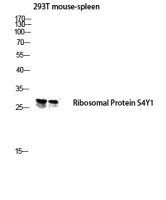 RPS4Y1 antibody