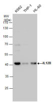 IL12B / IL12 p40 antibody
