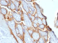 hCG beta antibody [SPM529]