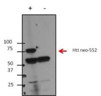 Huntingtin (neoepitope 552) antibody [4-13]