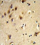 Histone H2A type 1H antibody, N-term