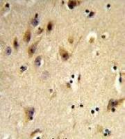 Histone H2A type 1H antibody, N-term