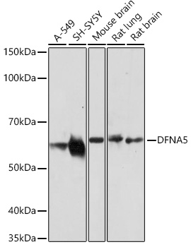 DFNA5 antibody