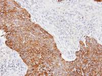 Cytokeratin 14 antibody