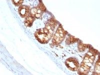 Cytokeratin 18 antibody [KRT18/1190]