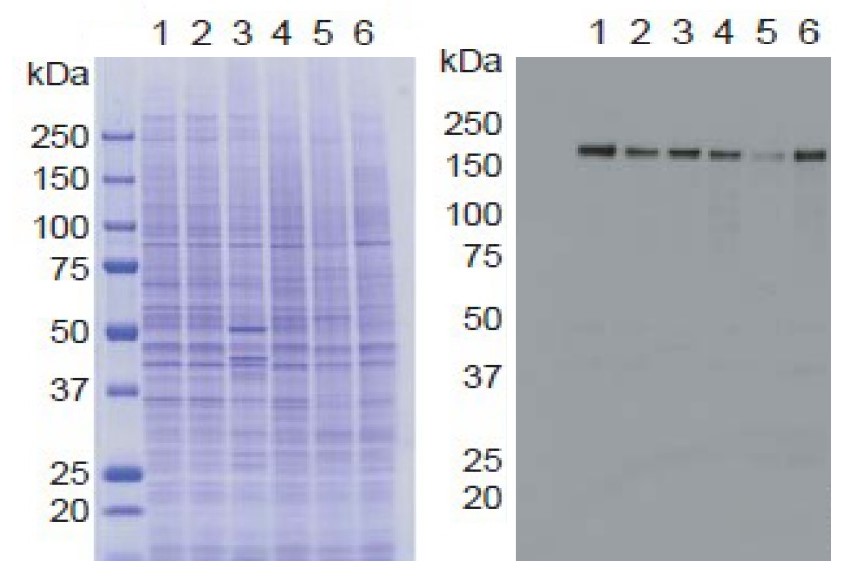 KDM5A / Jarid1A / RBBP2 antibody [9A6]