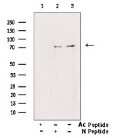 FOXO1 (Acetyl Lys294) antibody