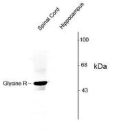 Glycine Receptor alpha 1/2 antibody, N-term