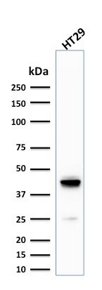 Cytokeratin 20 antibody [KRT20/1992]