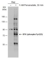 BTK (phospho Tyr223) antibody