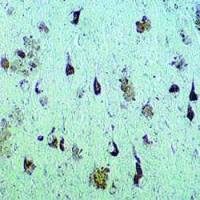 Neurofibrillary Tangles antibody