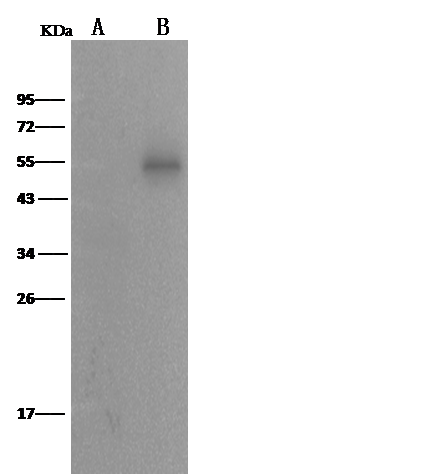 ALDH7A1 antibody [04]