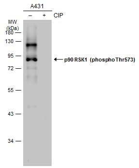 p90 RSK1 (phospho Thr573) antibody
