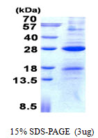 Human AICDA protein, His tag