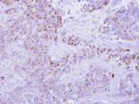 I-309 antibody