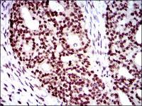 WHSC2 antibody [6B11H8]