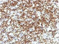 PAX7 antibody [PAX7/1187]