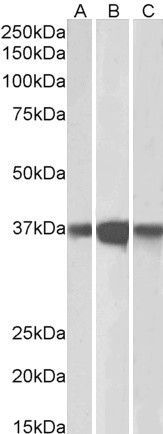 PP2A alpha + PP2A beta antibody, C-term