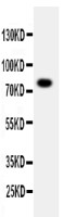 PPP1R15B antibody