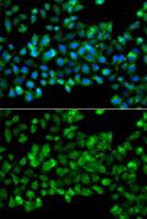 CBR3 antibody