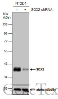 SOX2 antibody