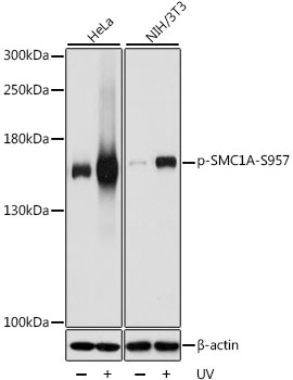 SMC1 (phospho Ser957) antibody
