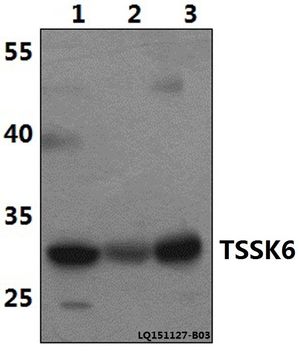 TSSK6 antibody