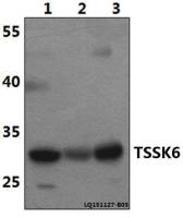 TSSK6 antibody