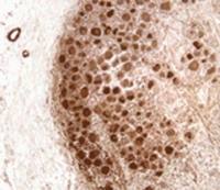 Neurofibromin antibody [McNFn27b]