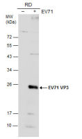 Enterovirus 71 VP3 antibody