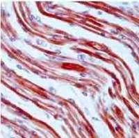 Tropomyosin antibody [SPM224]