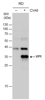 Coxsackievirus A6 VP1 antibody