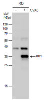 Coxsackievirus A6 VP1 antibody