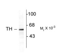 Tyrosine Hydroxylase antibody