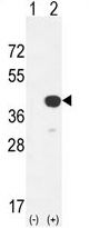 Cathepsin K antibody, Internal