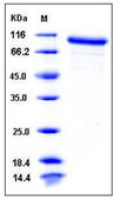 Mouse MMP9 protein