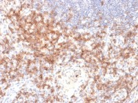 CD27 antibody [LPFS2/2034R]