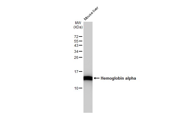 Hemoglobin alpha antibody [GT1234]