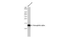 Hemoglobin alpha antibody [GT1234]