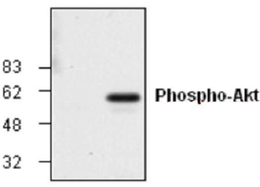 AKT (phospho Ser473) antibody