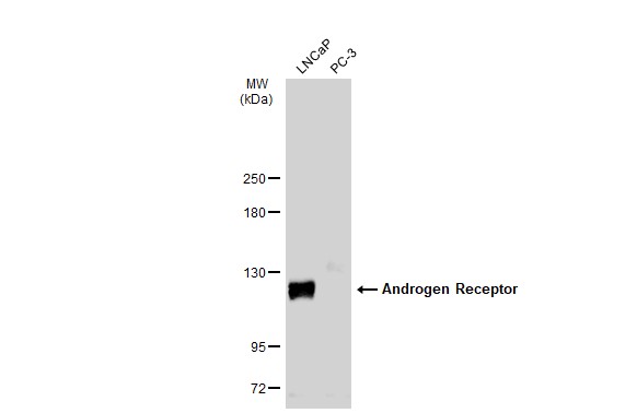 Androgen Receptor antibody [N1], N-term