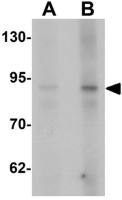 AFAP antibody