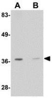 RGS21 antibody
