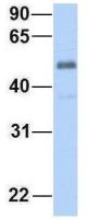 ZGPAT antibody, C-term