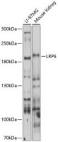 LRP6 antibody