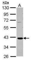 GALM antibody