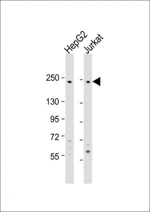 Laminin beta 2 antibody, C-term