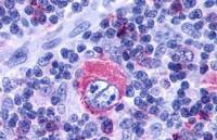 Leukotriene B4 Receptor 2 antibody