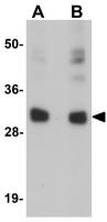 CCDC106 antibody