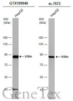 Villin antibody